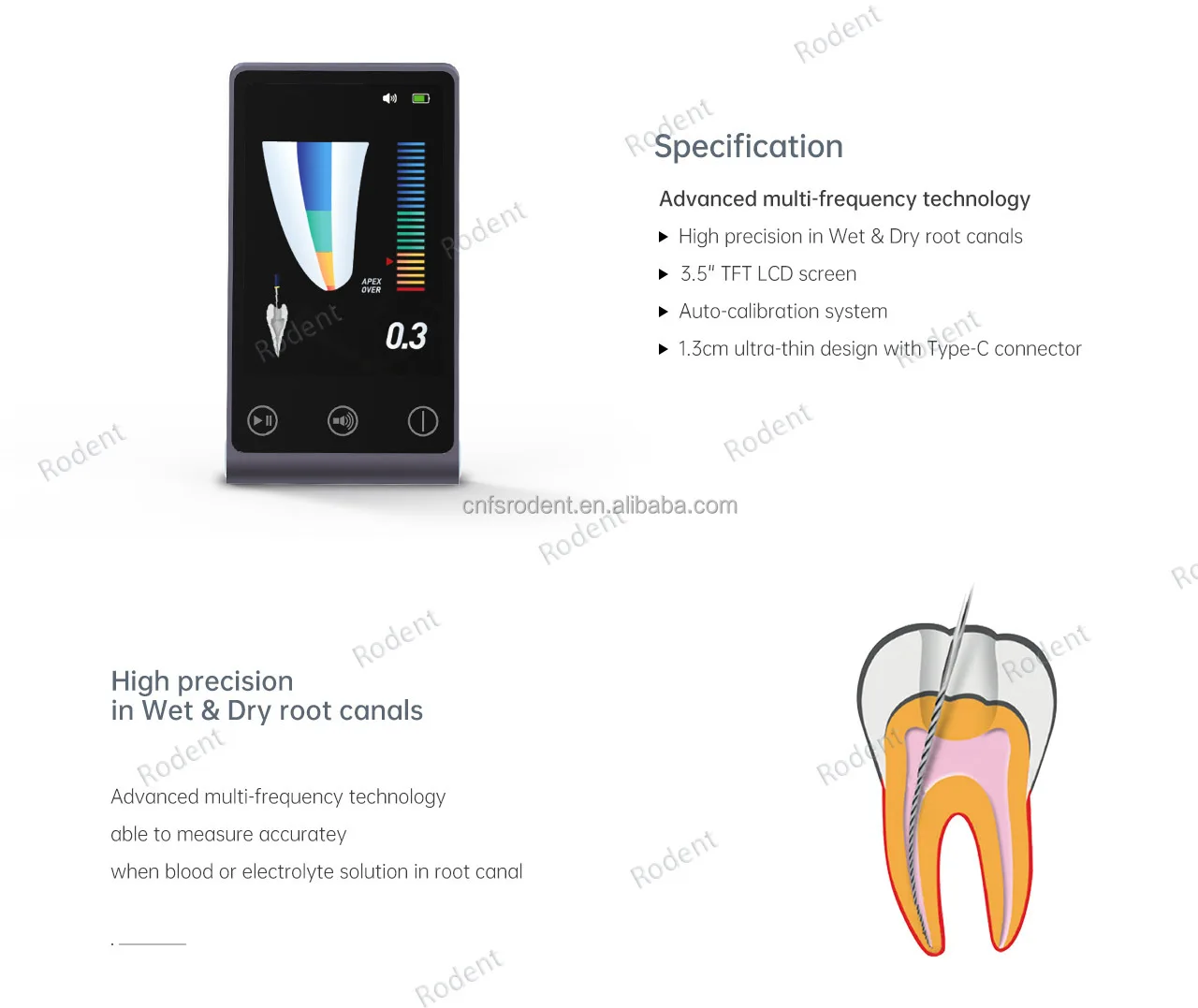 den tal Instrument Wurzelkanalbehandlung Denthefte Genaue Apikalische Messung Mini den Tal Endo Apex Locator