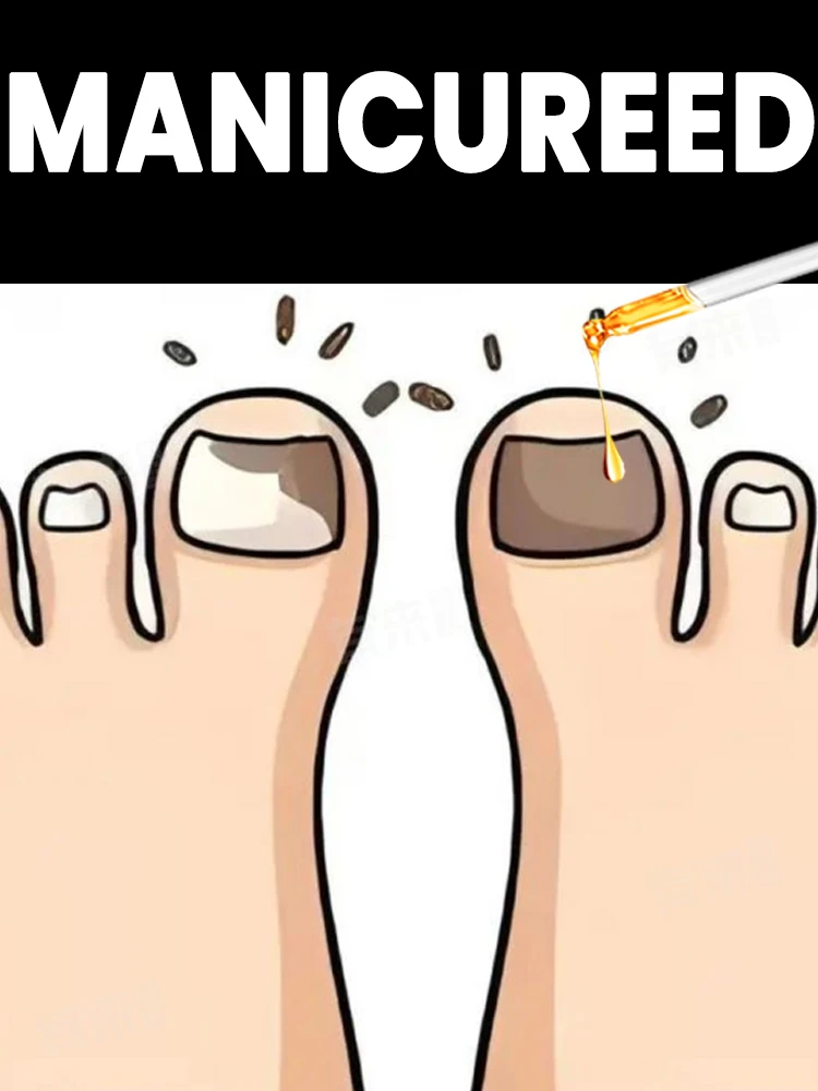 

Генерация-1,омоложение - Технология предотвращения грибка - Регулируемый датчик управления и безопасности Инструменты для ухода за ногами