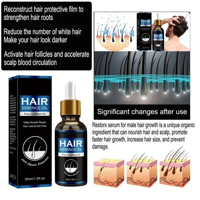 Productos de aceite para el crecimiento rápido del cabello para hombres y mujeres, reparación eficaz de la calvicie, tratamiento anticaída del cabello