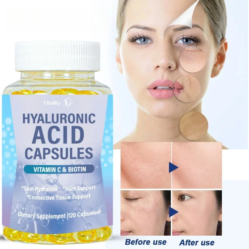 Vitality Hyaluronic Acid Cápsulas para promover articulações, pele jovem e apoio, tecido conjuntivo