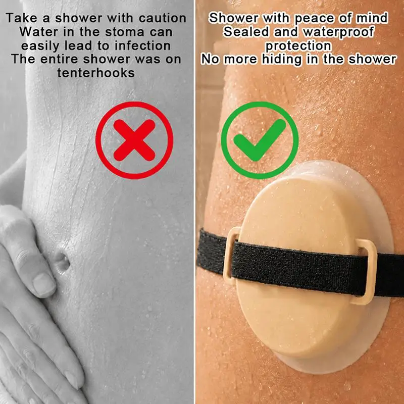 1 Stück Silikon Wasserdichter Verstellbarer Dehnbarer Versiegelter Stoma-Gürtel-Überzug Stoma-Badabdeckung DIY-Zubehör – Detail 3