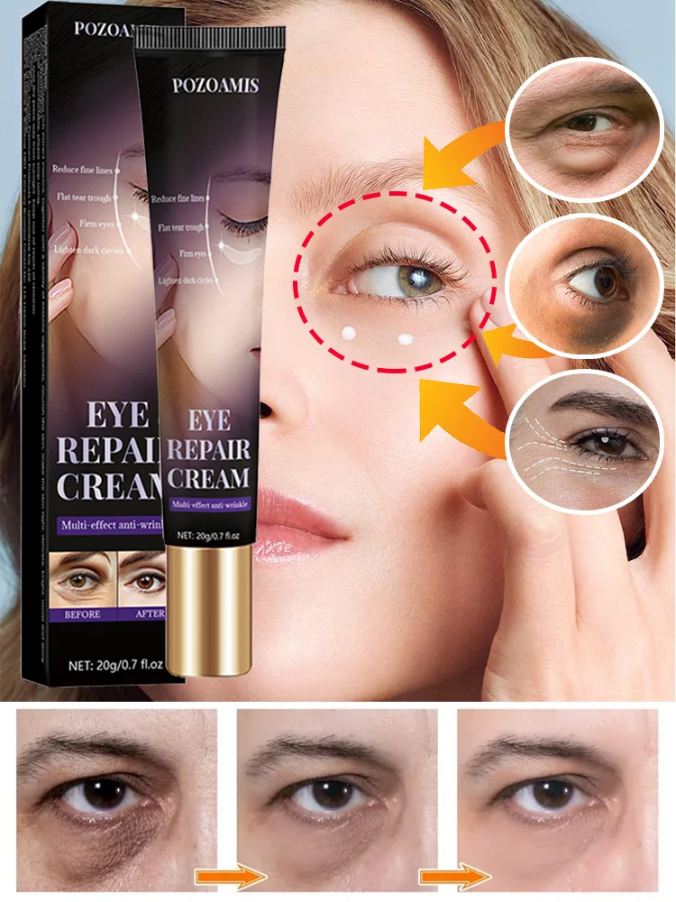 

Let you say goodbye to aging eye bags and dark circles, and become younger