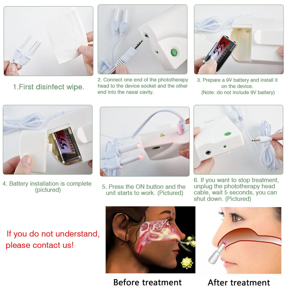 Nose Care Device Proxy BioNase Therapy Machine Nose Rhinitis Sinusitis Cure Hay Fever Low Frequency Laser Runny sneeze treatment