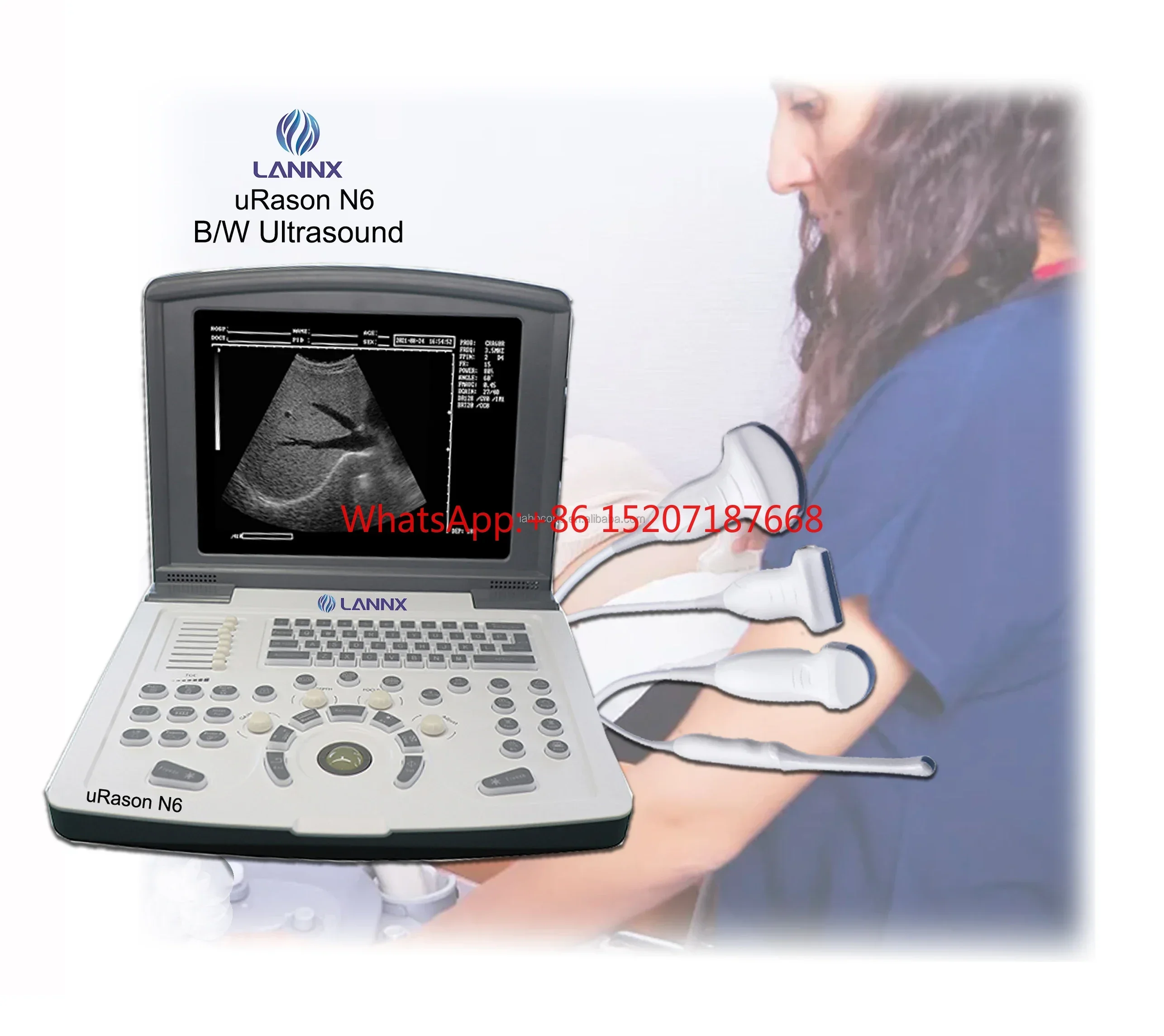 uRason N6 Customization  OB GYN Echocardiography Machine Laptop Portable Ultrasound Scanner ecografo portatil