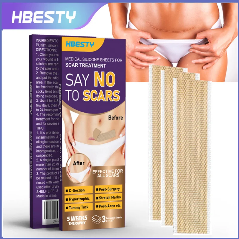 

HBESTY Scar Silicone Patch Pregnancy Burn Surgery Scar Lightening Waterproof Skin Care Patch