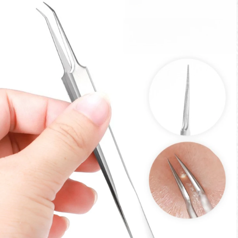 1/2 pz Doppio Anello di Rimozione di Comedone Popper Acne Comedone Blemish Brufolo Estrattore In Acciaio Inox di Rimozione di Comedone Viso pulito