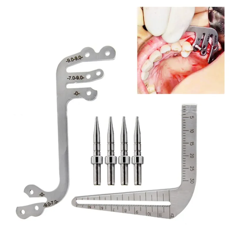 مجموعة لوحة دليل زرع الأسنان، محدد موقع الزرع، لوحة دليل تحديد المواقع، مسطرة تحديد المواقع #2