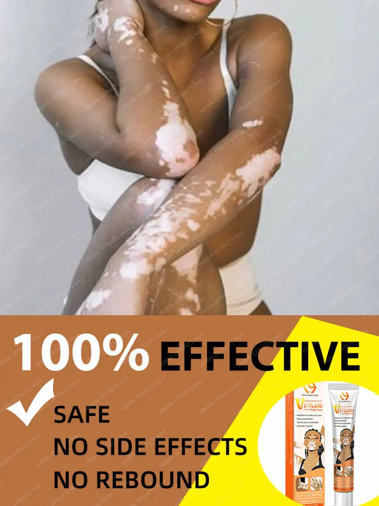 

Improve vitiligo laser