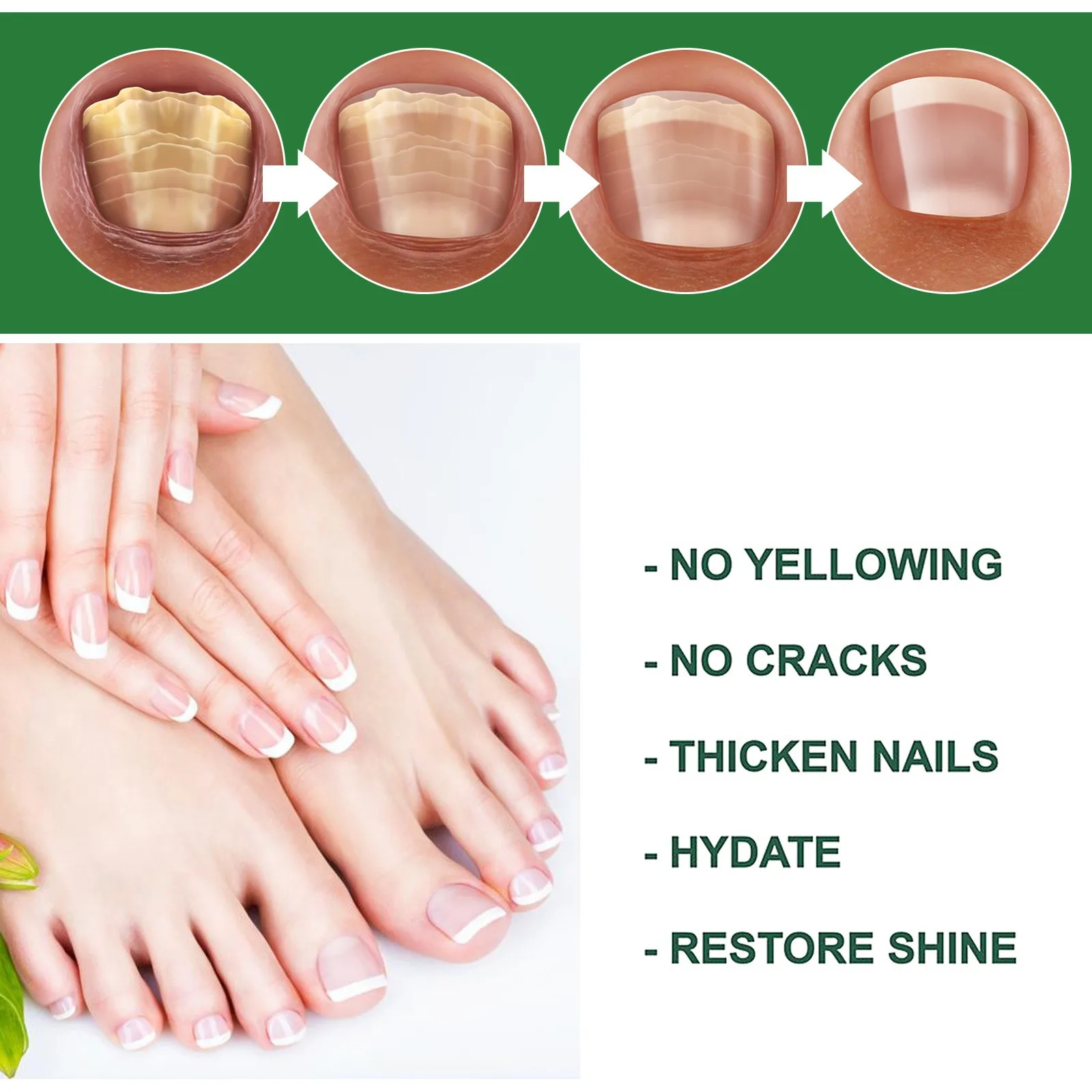 Intense Nail Growth And Strengthening Serum 7 Days Nail Growth And Strengthening Serum Nail Strengthener For Thin Nails