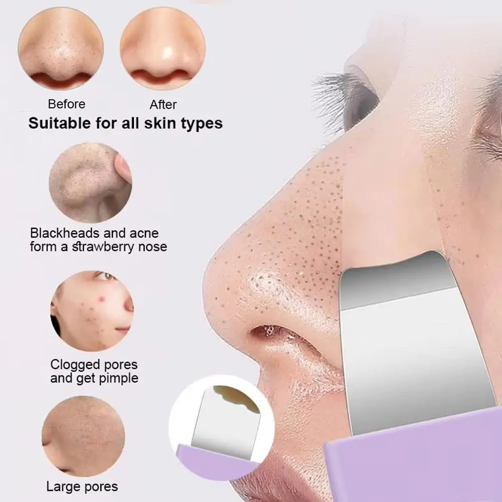 Outil d'élimination des points noirs en acier inoxydable, nettoie en profondeur les Pores, exfolie en douceur pour la beauté du visage, outil de soins de la peau