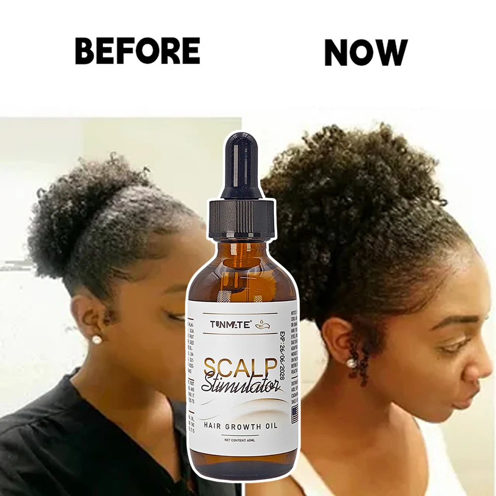 

1/2/3pcs Hair Growth Oil Hair Thickening Serum Regrowth Essential-Oil Reduces Breakage Scalp Care Product For All Hair Types