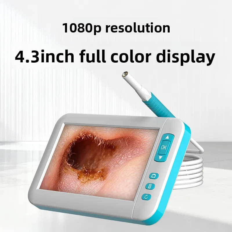 All-in-One Technician-Exclusive Visualization Ear-Cleaning Instrument Otoscope LED Illumination IP67 Waterproof Model C01
