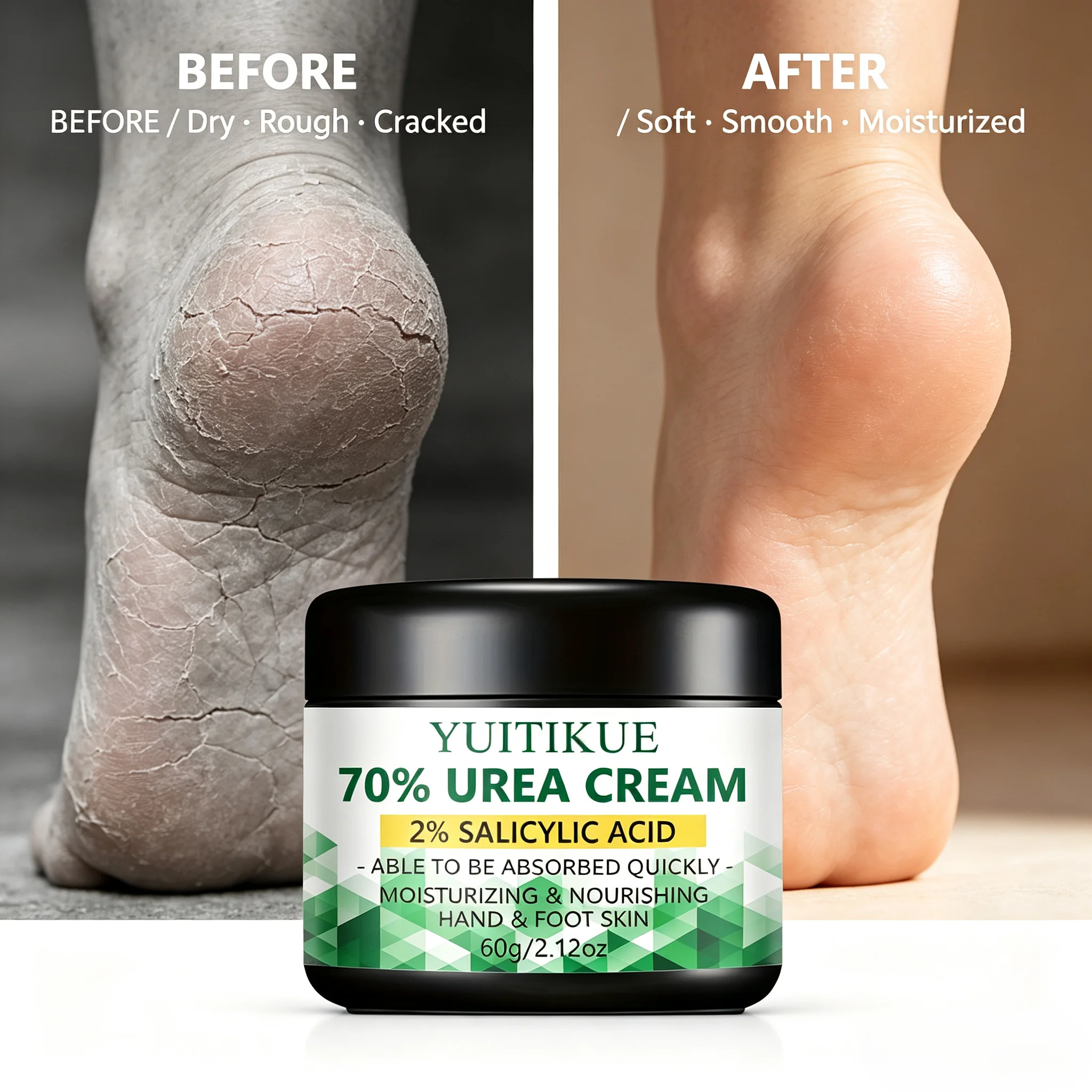 Creme de Ureia 70% 60g, Ácido Salicílico 2%, Tratamento para Calcanhares Rachados, Removedor de Calos, Hidratação Intensa