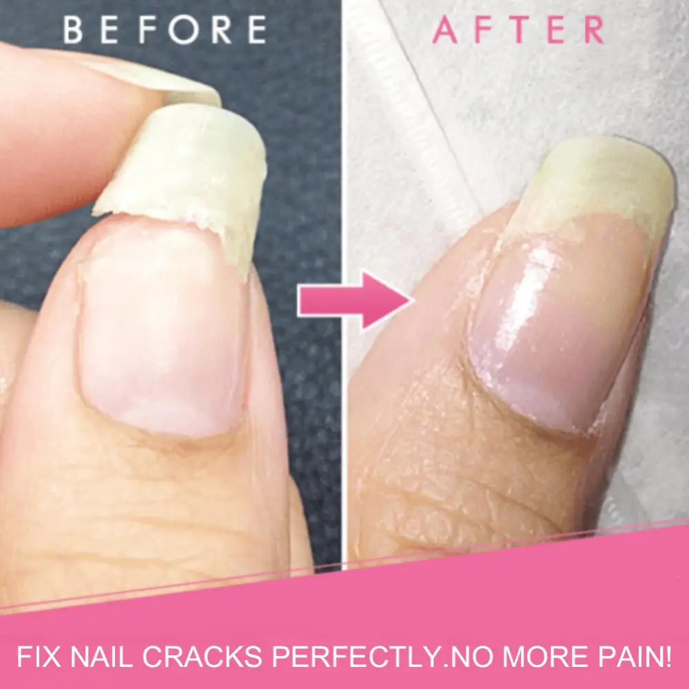 Base Coat Manicure 5ml Cracked Broken Nails Extentions Repair Gel Treatment Instantly fill in and fix nail cracks effectively.