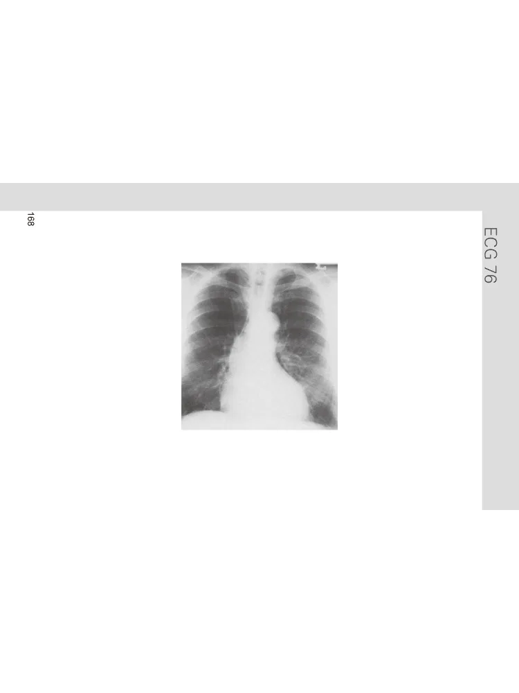 Book-Winshare Easy Interpretation Of Ecg 5th Edition