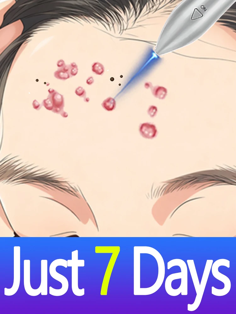 

New Upgrade Tool Set ᴮˡᵘᵉ ˡᵃˢᵉʳ ᵖᵉⁿ ʷᵃʳᵗ ʳᵉᵐᵒᵛᵃˡ· ᴾˡᵃˢᵐᵃ ʷᵃʳᵗ ʳᵉᵐᵒᵛᵃˡ ᵗᵉᶜʰⁿᵒˡᵒᵍ