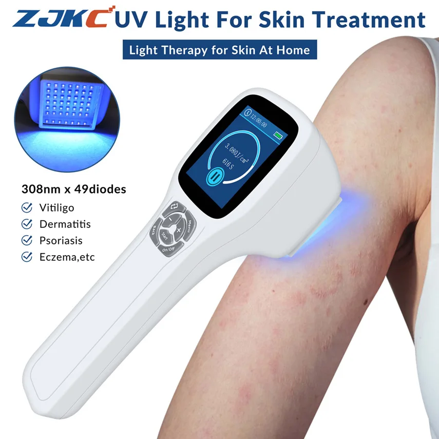 

ZJKC 308nm Excimer System Uv Light Therapy for Psoriasis Vitiligo Eczema Skin Diseases Treatment Phototherapy Device