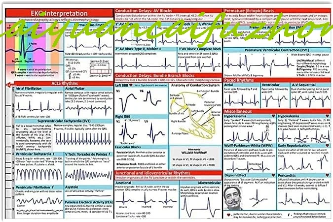 Ekg Interpretation Metal Tin Sign Cardiologist Knowledge Posters Doctor Office Decor Hospital Clinic Popular Science Wall Decor