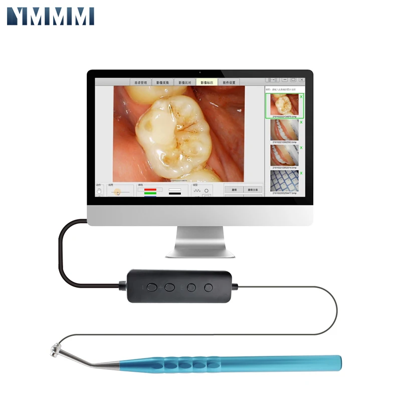 

Dental Sandblaster LED Dental Digital Micro Intra-Oral Camera Wifi Foot Control HD Visual Intraoral Scanner Fit Endo Motor Tools