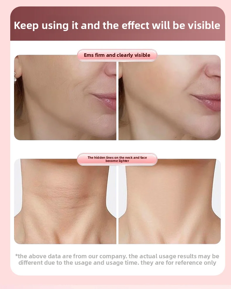 EMS مكركرنت الأسطوانة الوجه التخسيس قطعة أثرية V-Face الجمال مدلك الوجه لشد ورفع الوجه #5