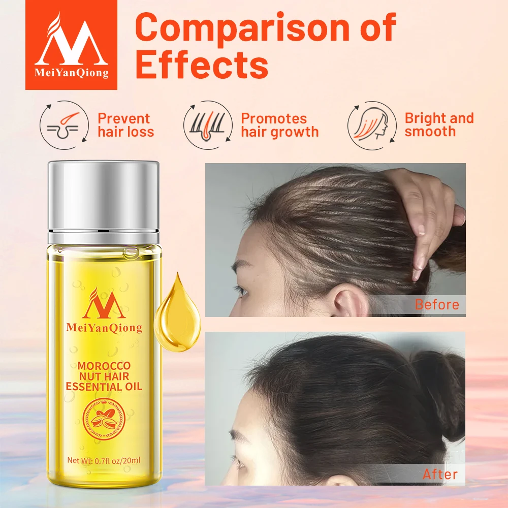 Fast Powerful Hair Growth Essence Hair Loss Products Essential Oil Liquid Treatment Preventing Hair Loss Hair Care Products 20ml