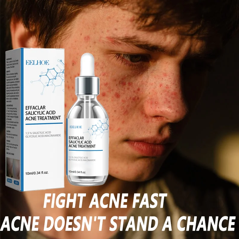 

Крем для лечения прыщей с салициловой кислотой, сужающий поры, удаляет черные точки, следы от прыщей, контроль жирности пятен, отбеливание, уменьшает покраснение, отеки