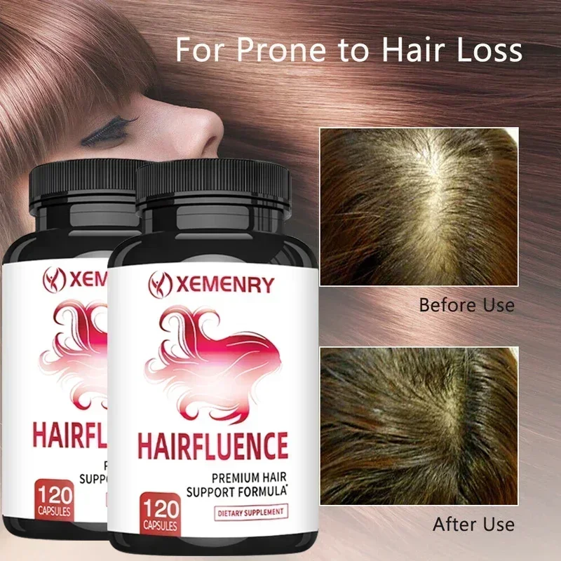 

Hair Growth - with Biotin, Supports Healthy Hair Growth, Increases Hair Density, Nourishes The Scalp, and Reduces Frizz