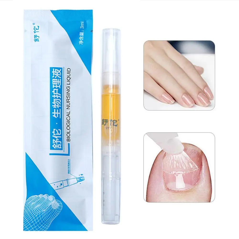 20g Nail Fungus Cuticle Remover Oil Rehydration Solution Toe Fungal Fungus Oil Nails Anti Treatment Dropshipping Finger Liq T9N0