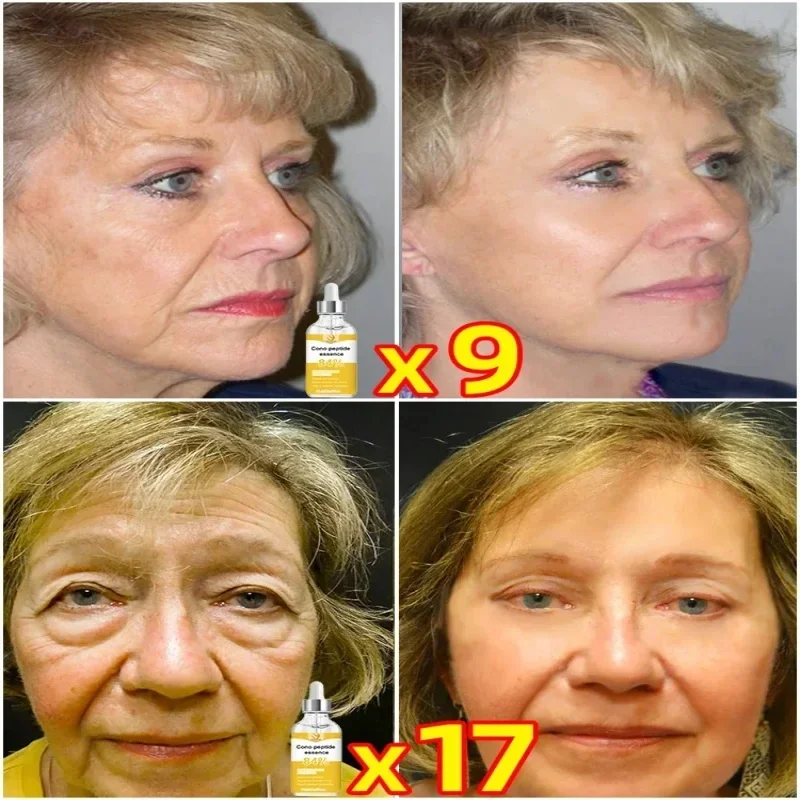 Anti-aging Serum Wrinkle Remover Reduce Neck Face Lines Anti Age Collagen Boost Skin Moisturizing Care Products For Women