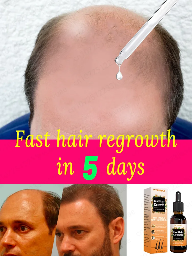 Aɴᴛɪ ʜᴀɪʀ ʟᴏss, ʜᴀɪʀ ғᴀsᴛ ɢʀᴏᴡᴛʜ ɴᴜᴛʀɪᴛɪᴏɴ ᴇssᴇɴᴄᴇ