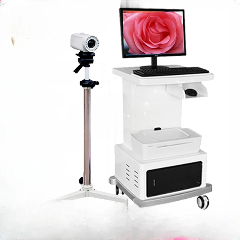 Electronic colposcopy diagnostic instrument HD lens 3 megapixel female gynecological endoscopy instrument medical