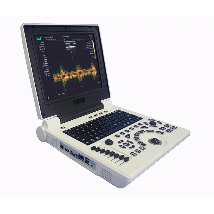 Factory Manufacture Various P20 Notebook Ultrasonic Diagnostic System Machine China Premium Ultrasound