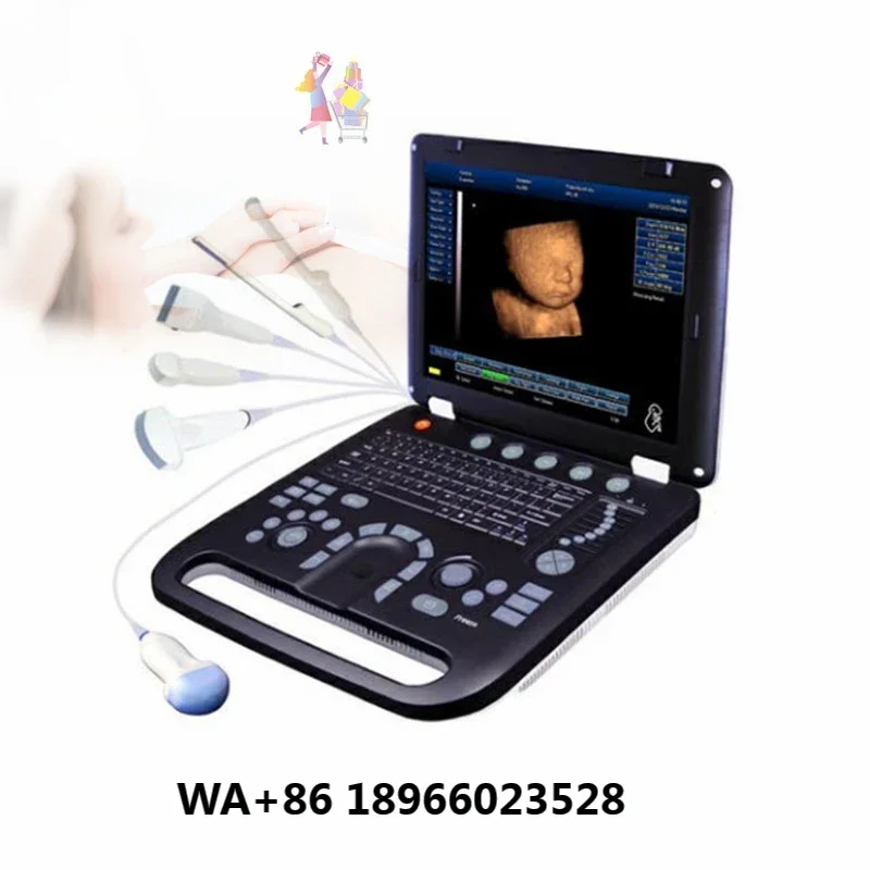 Medical 3D 4D Ultrasound Instruments full digital Color Doppler Ultrasonic Diagnostic System