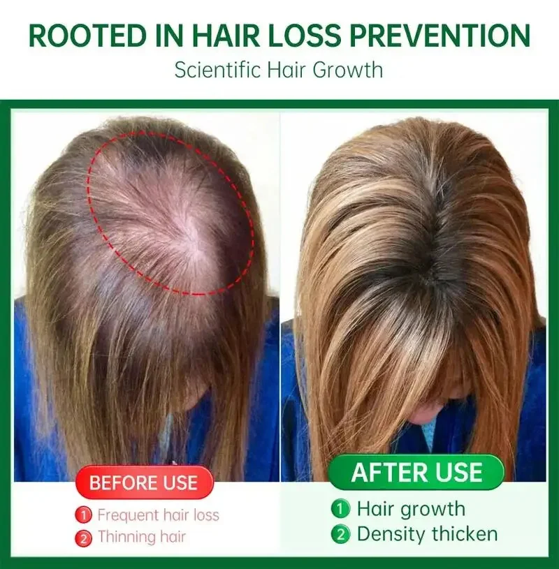 Powerful Hair Growth Serum Spray Anti Hairs Loss Product Repair Nourish Roots Promote Regrowth Thicken Hairs Care For Men Women