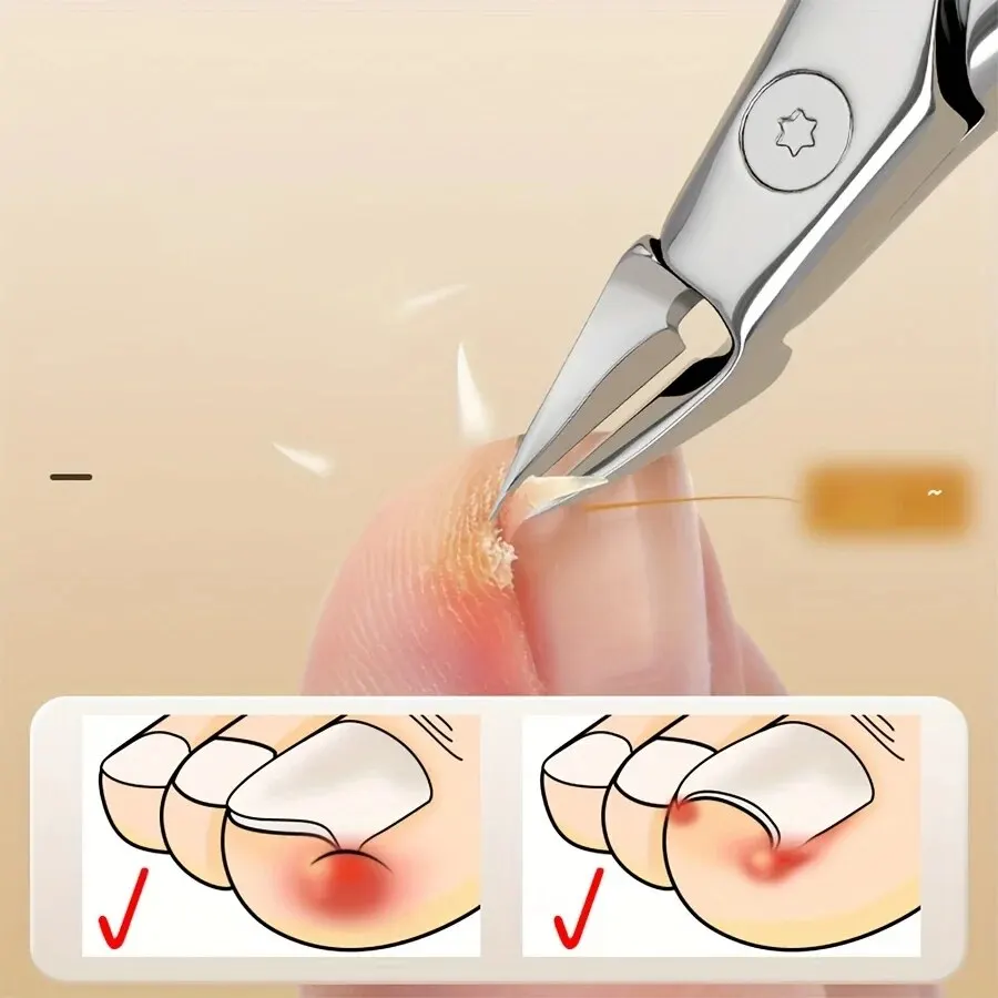 NIEUWE Nagelknipper Teennagelsnijders Pedicure Manicure Gereedschap Anti-Splash Ingegroeide Paronychia Professionele Correctie Tool Sets