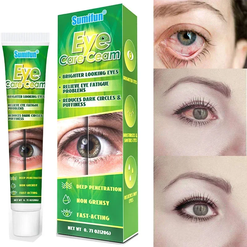 Chinese Herbal Medicine Eye Care Creme, olhar mais brilhante olhos aliviar, fadiga problemas, reduz círculos escuros e inchaço