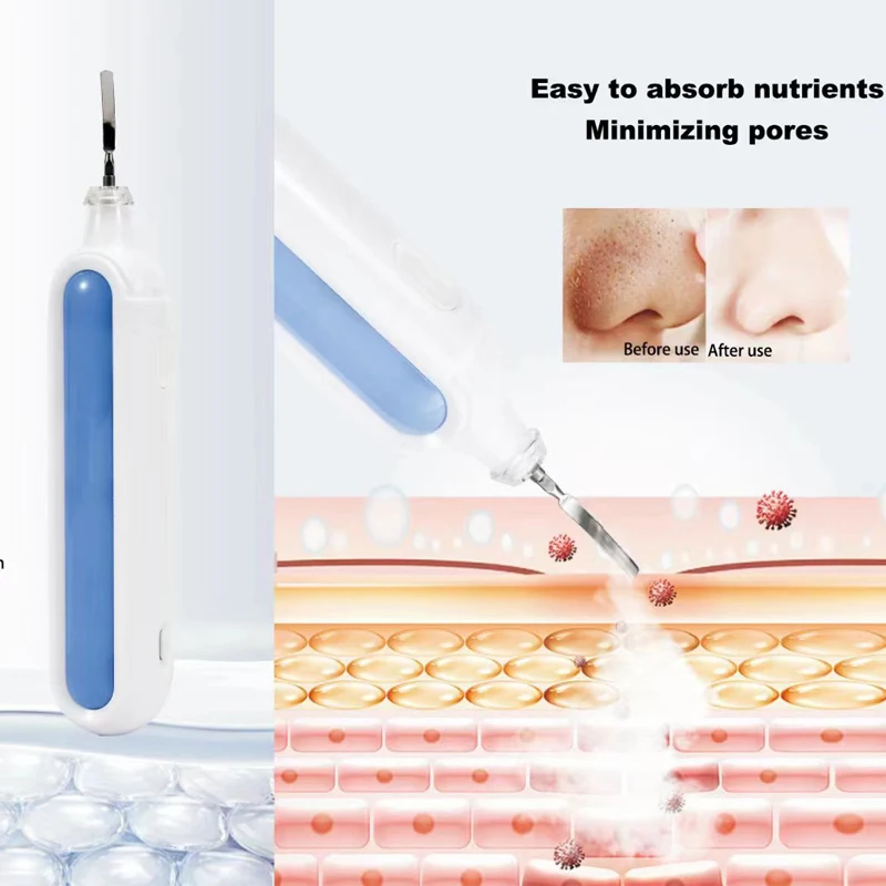 Handheld gezichtsoogmassageapparaat Hoogfrequente trillingen Schoonheidsapparatuur Schoonheidsapparaat