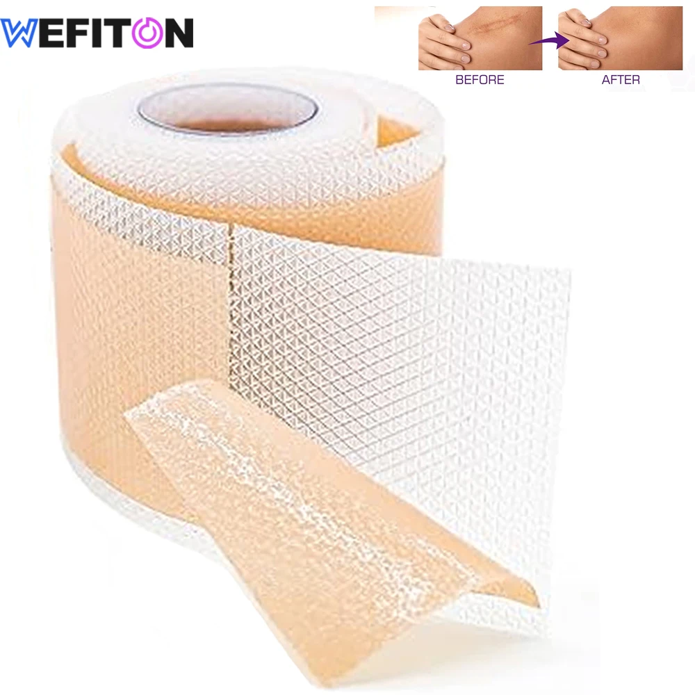 1 rollo de hojas de silicona para cicatrices, cinta de Gel suave, Flexible para cirugía, cheloides, heridas, piel sensible, protección de heridas, parche curativo