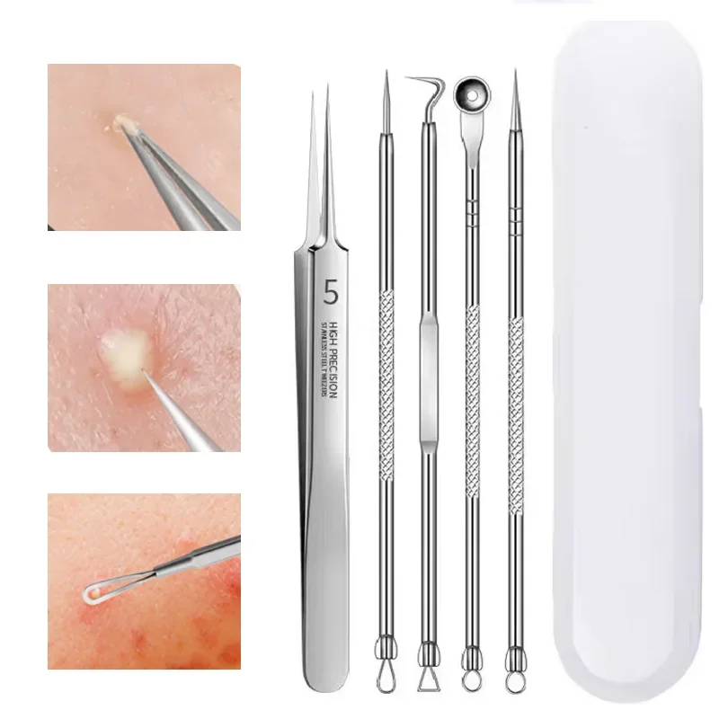 4/5 PCS rimozione di punti neri Comedones Extractor Kit di rimozione dell'acne per Blemish Whitehead Popping Zit rimozione per strumenti viso naso