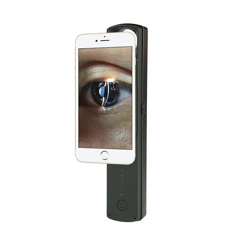 

S150 portable slit lamp hand held smartphone images eye anterior segment examination