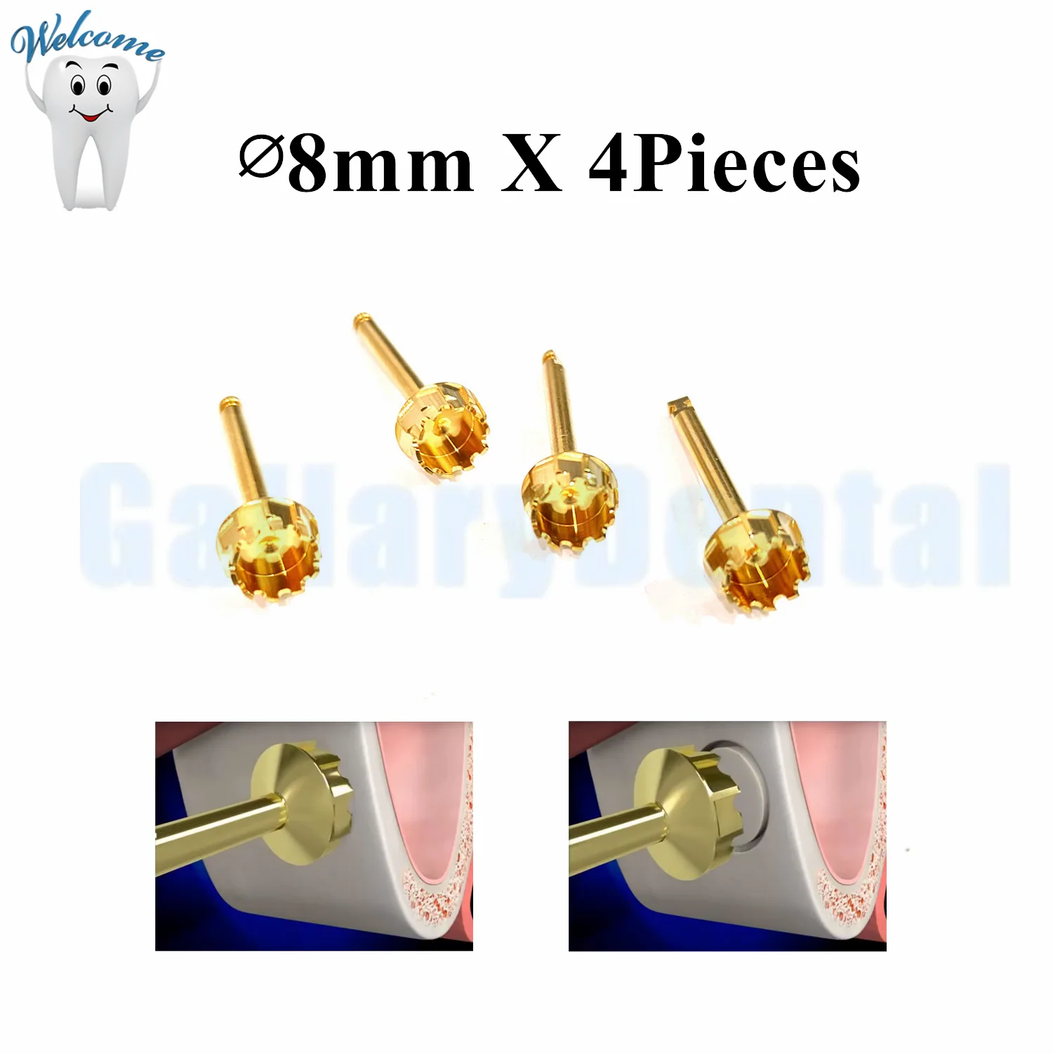 

4 шт. резак для имплантации зубов, сверла для бокового приближения, Sinus Lift Burs ∅ 8 мм ITI Straumann