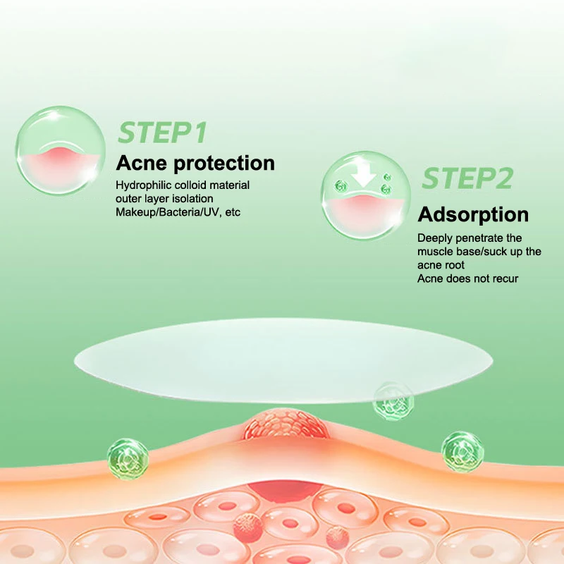 1/5Pcs Acne Patch Invisible Hydrocolloid Concealer Acne Patch Light Breathable Suction Pus Essential Oil Acne Patch