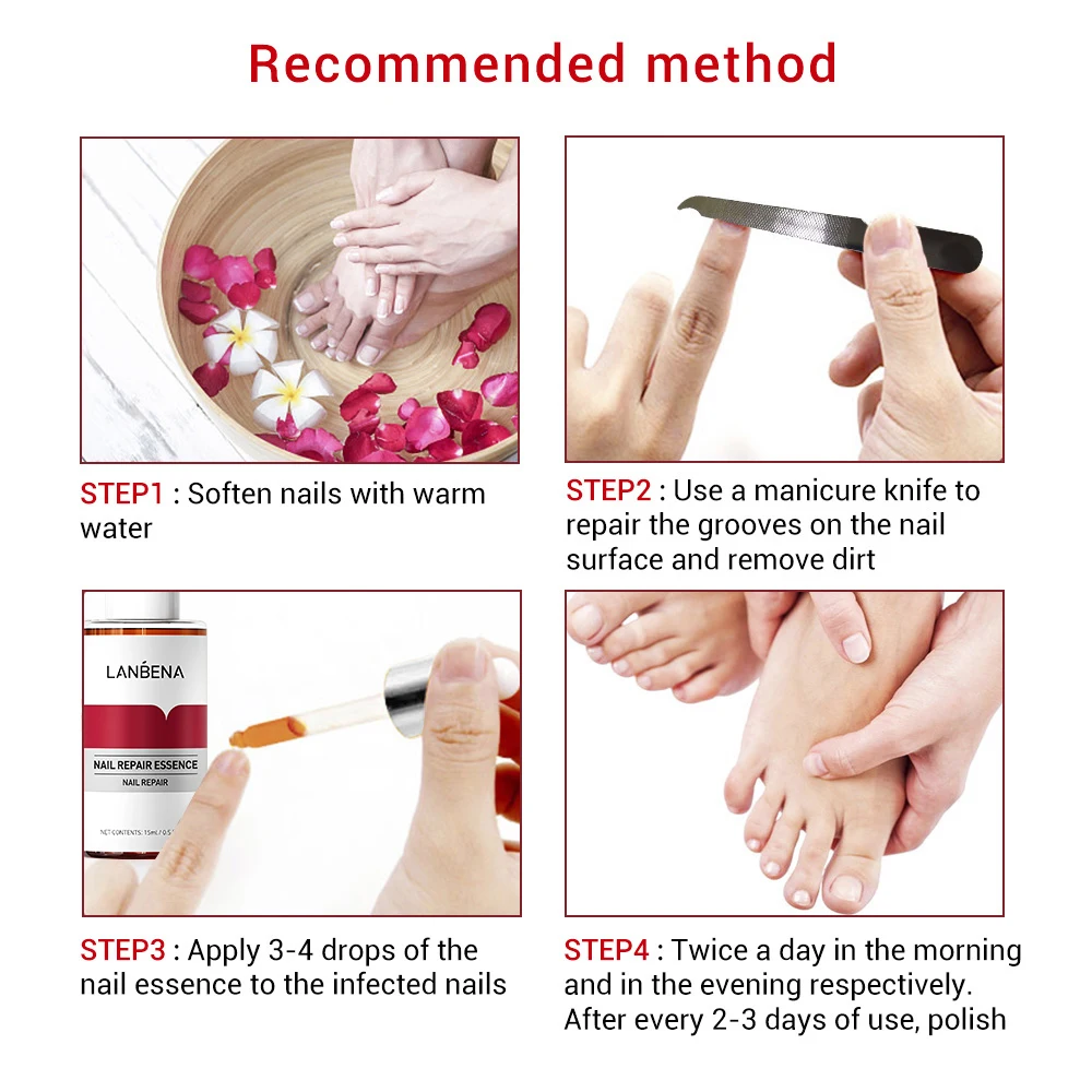 1/2/3/5PCS Fungal NAIL Repair Essence Serum Liquid มือเท้านิ้วมือเล็บผลิตภัณฑ์ดูแล Anti Paronychia Onychomycosis Toe Care