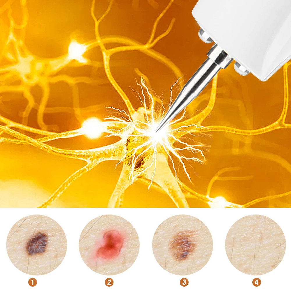 9 Gear Plasma Pen Freckle Remover Machine Skin Tag Black Dot Dark Spot Remover Laser Pen Beauty Care Tools