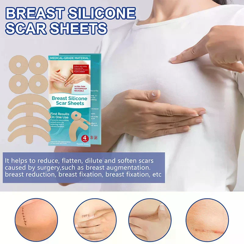 قابلة لإعادة الاستخدام هلام السيليكون ملصقات غير مرئية قوس دائري الصدر غير مرئية المخفي ندبة رقعة إصلاح الوشم عيب إخفاء الشريط #5