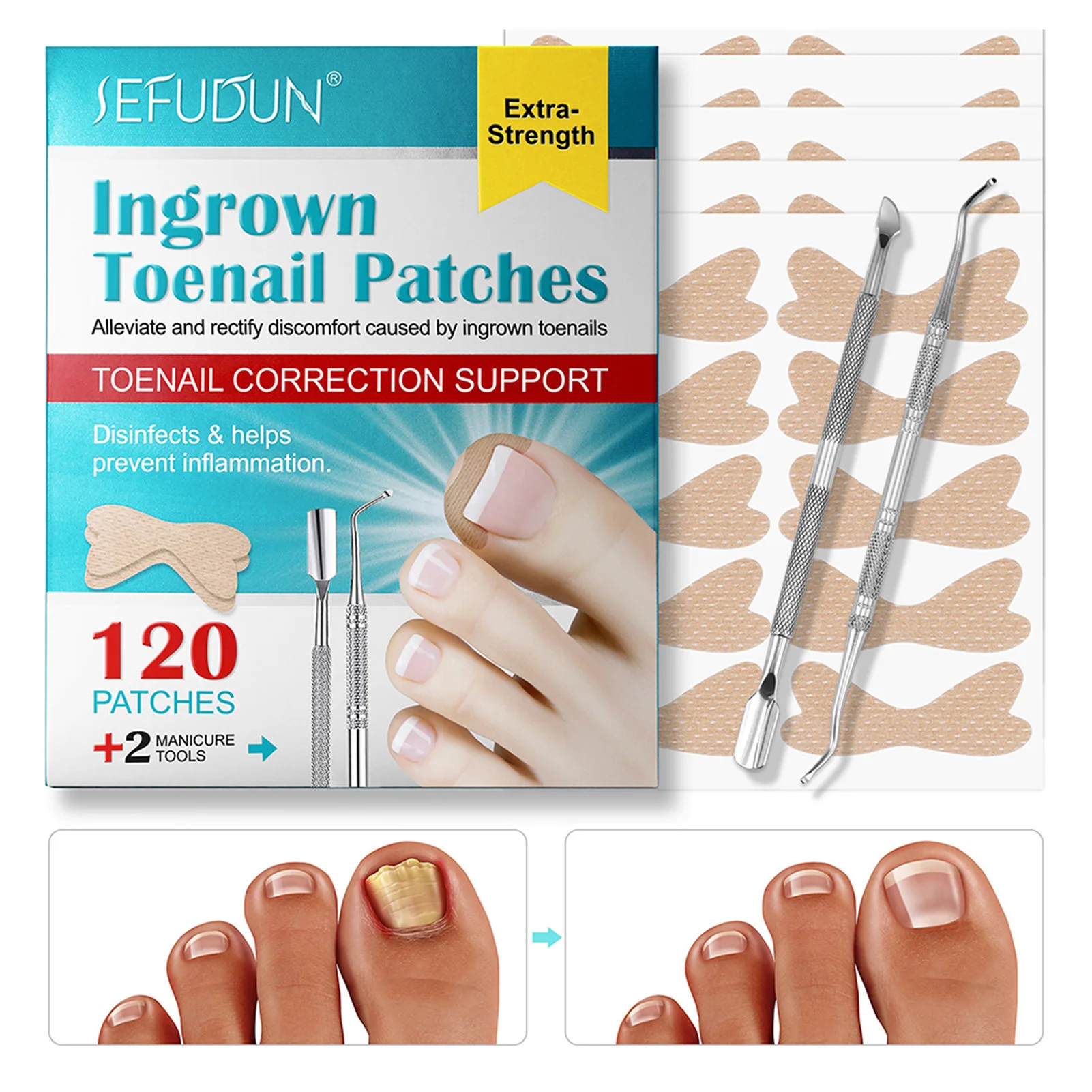 120PCS Toenail Correction Plasters Kit Skin-Friendly Comfy Patchs Nail Care Supplies