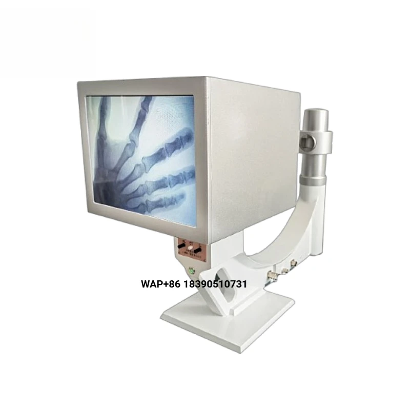 Lightweight portable medical X-ray machine with 10-inch LCD screen that can display images in real time, suitable for use in amb