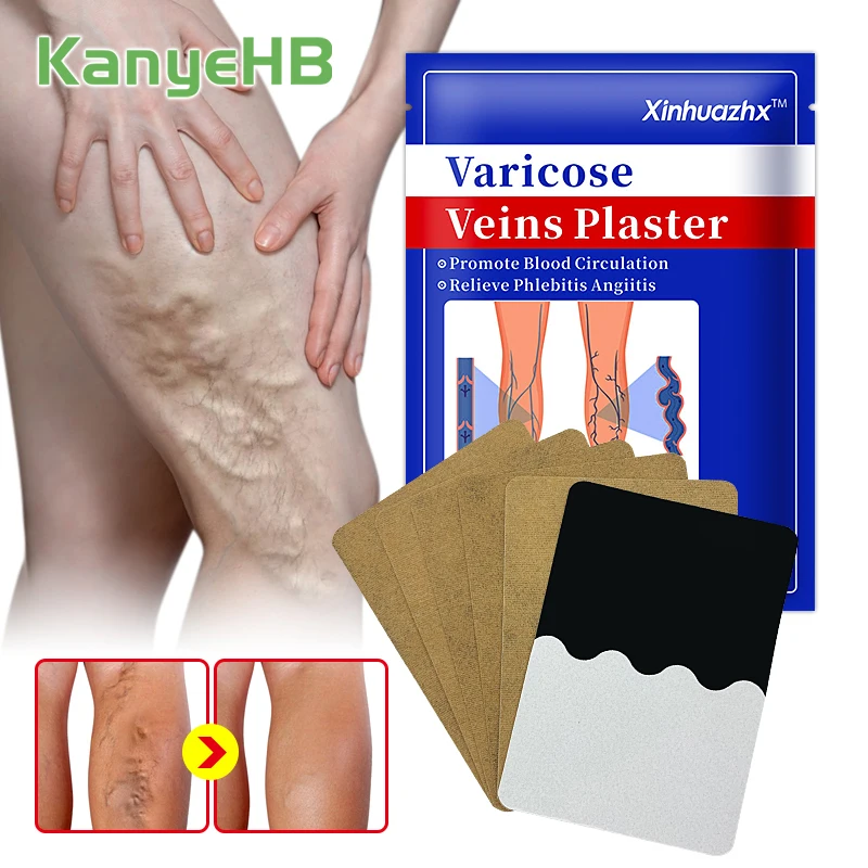 6pcs=1bag Varicose Vein Plaster Smooth Leg Skin Venous Protrusion Spider Veins Herbal Varicosity Patch Vein Healthcare H139