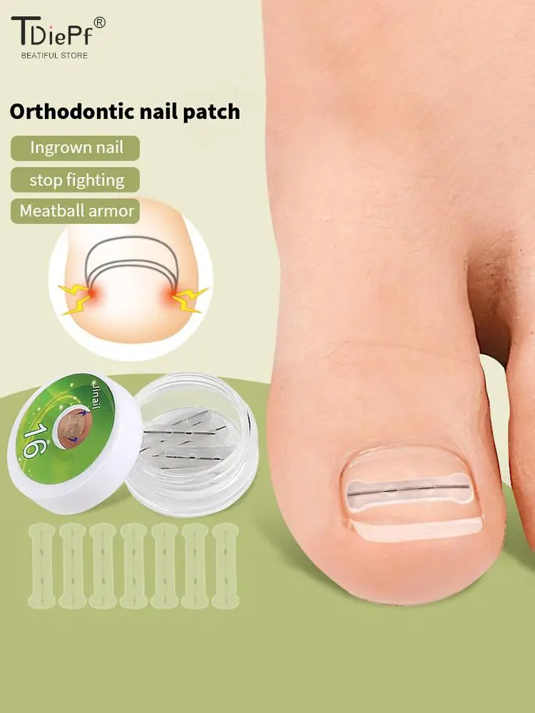 Ingrown Toenail Corrector Tools Pedicure Recover Embed Toe Nail Treatment Professional Ingrown Toenail Correction Foot Care Tool