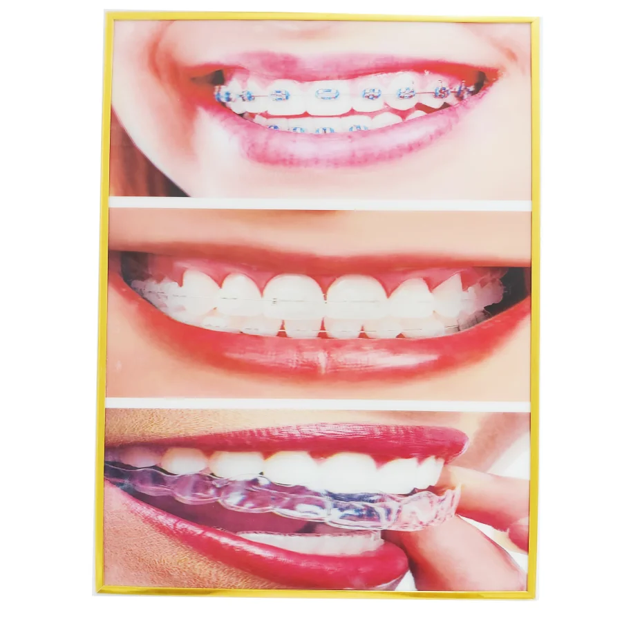 foto decorativa da parete con - Teeth Whitening For Photos recensione e prezzo